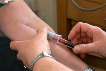 Statin side-effects 'strongest predictor' patient is missing cholesterol targets