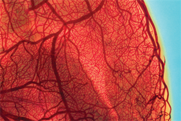 Chest pain - Red flag symptoms