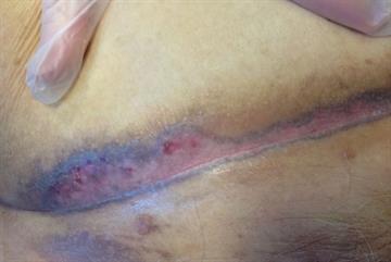 Case study: Diagnosing a persistent rash