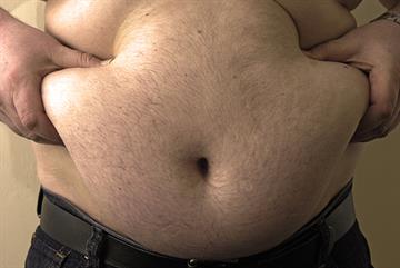 Obesity 'doubles risk' of vaccinated adults developing flu