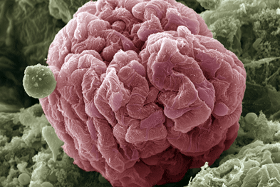 Kidney glomerulus: diagnostic test not dependent on kidney function (Photograph: SPL)