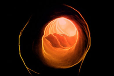 Cartoid atherosclerosis was seen to decline in patients who lost weight and reduced systolic BP (Photograph: SPL)
