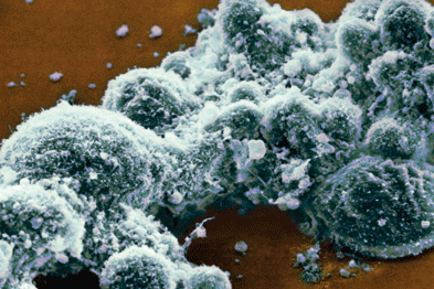 Herpes simplex: cells infected (Photograph: SPL)
