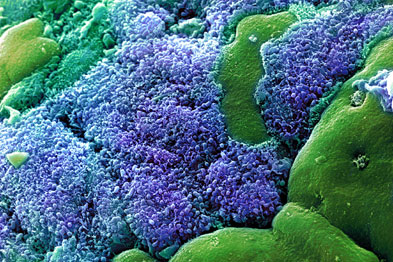 E Coli bacteria are the cause of the majority of uncomplicated UTIs