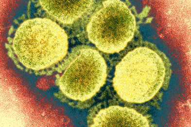 Swine flu: patients with influenza-like illnesses should have chest X-ray (Photograph: SPL)