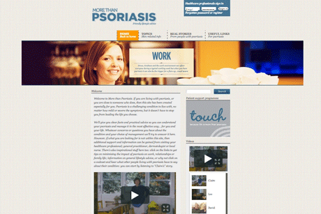Dobovet gel: Helping psoriasis sufferers