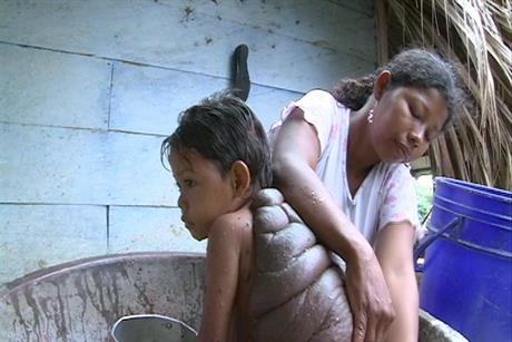 Documentary: ‘A Bodyshock Special: Turtle Boy’