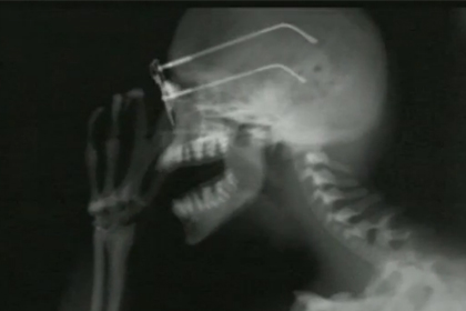 Tomorrow's Talent: Renault, x-rays