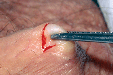 Testicles Hurt After Sex 72