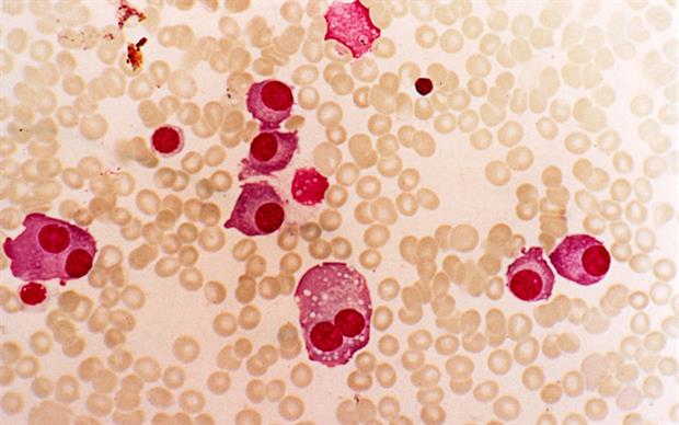 The antineoplastic agent is also indicated in the treatment of multiple myeloma | SCIENCE PHOTO LIBRARY