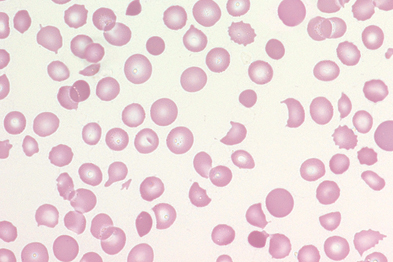 lymphocyers shed cell fragments