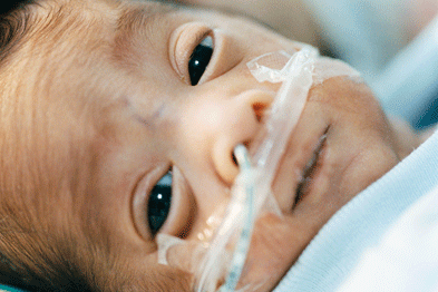 A premature baby with severe bronchiolitis may benefit from CPAP (photograph:spl)