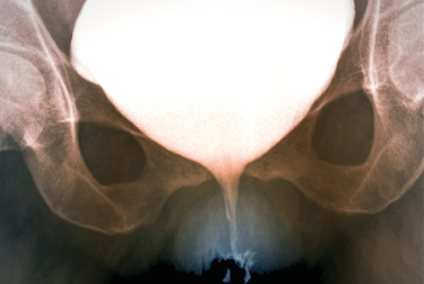 leaking urine clinical review of urinary incontinence epidemiology diagnosis and management gponline leaking urine clinical review of urinary incontinence epidemiology diagnosis and management gponline