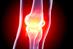 PLMR appointed by Arthritis Research UK
