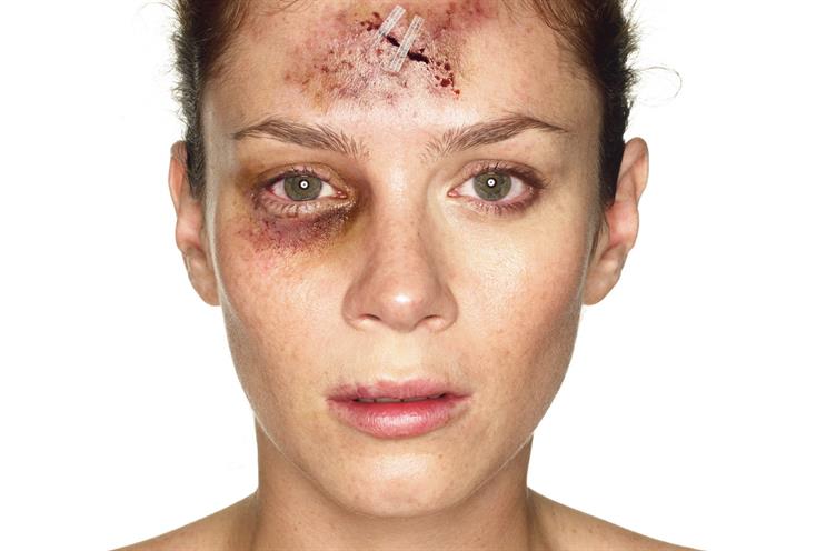 ‘Act’: called for action by showing the physical effects of violence