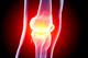 PLMR appointed by Arthritis Research UK
