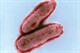 Clinical Review - Bacterial meningitis in children