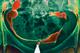 Clinical Review - Ovarian cancer