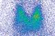 Journals Watch - Thyroid cancer, pre-eclampsia and mammography