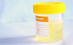 urinary uti symptoms antibiotics
