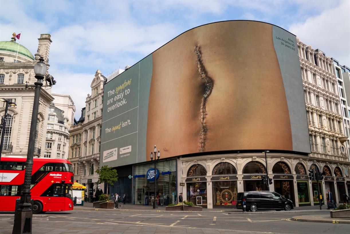 World Ovarian Cancer Day campaign features scars of real women