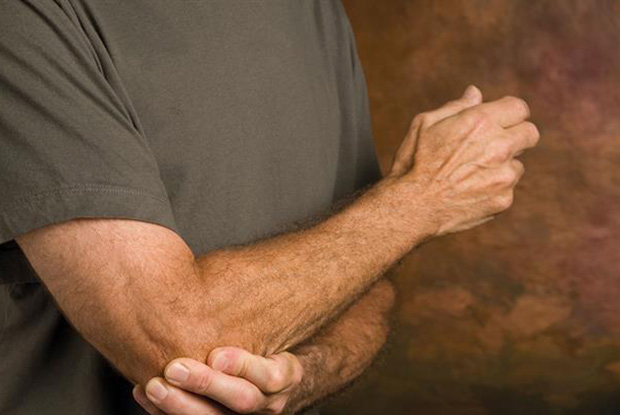 Tennis Elbow (lateral Epicondylitis) | GPonline