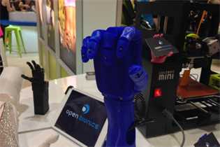 Open Bionics: creating 3D-printed prosthetics