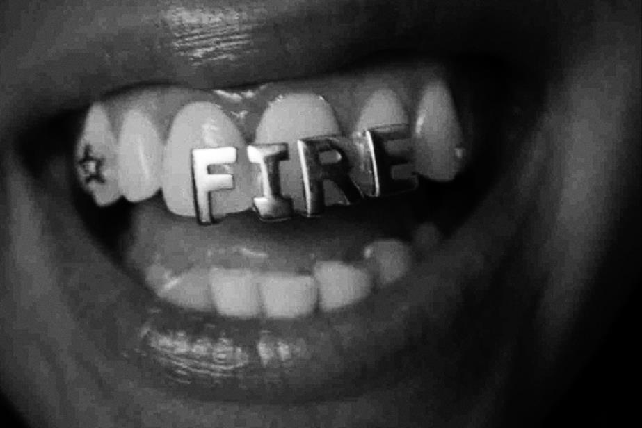Teeth grills that say Fire