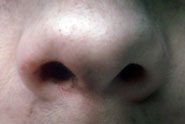 Frank 'nostrils' and 'heart' by Mother