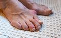 Two thirds of gout patients do not receive preventative treatment