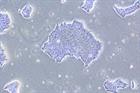 International Society for Stem Cell Research meeting opens in Melbourne