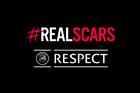 Red and white text on a black background saying: "Real Scars. UEFA Respect"
