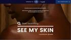Image from the See My Skin campaign