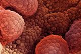 Prostate cancer: diagnosis via PSA velocity 'no better than PSA/age'