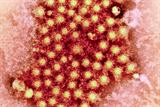 Local authorities are unprepared to fight infections of the hepatitis C virus (pictured), The Hepatitis C Trust warned (Photo: SPL)