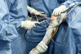 Knee replacement rates varied four-fold across regions (Photograph: SPL)