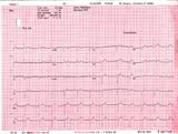 GPs exception reported 14.8% of heart failure patients