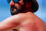 A change in the culture of tanning has led to an increase in skin cancer rates (Photograph: SPL)