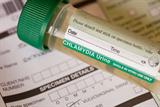 Training boosted the number of chlamydia tests offered by practice staff (Photo: Ashley Cooper, Visuals Unlimited/SPL)