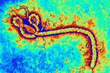 Ebola virus: GPs and practice staff call for advice (Photo: Science Photo Library)