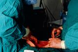 Hysterectomy was shown to be the preferred strategy for heavy menstrual bleeding (Photograph: SPL)