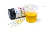 Urine sample (Photo: iStock)