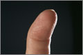 Athletes with mallet finger should be referred for X-ray and diagnosis