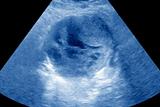 CCGs will be judged on access to ultrasound diagnostics (Photo: Science Photo Library)