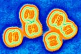 Neisseria meningitidis bacteria: the national vaccination programme has cut rates of meningococcal disease (photo: SPL)