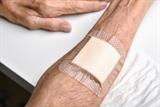 Wound dressing