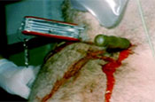 Anti-knife campaign