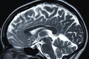 TV and the brain