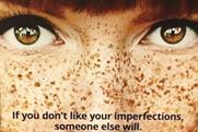 The buzz: Match.com apologises for freckles ad