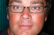 Lofgren: director of EuroContactPool